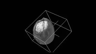 A Kinect NUI for 3D Medical Visualization