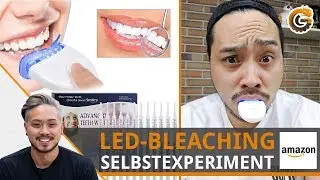 LED-Bleaching: Wei&szlig;e Z&auml;hne in 20 min? | Selbstexperiment