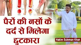 पैरों की नसों के दर्द से मिलेगा छुटकारा | Hakim Suleman Khan | Sadhna TV
