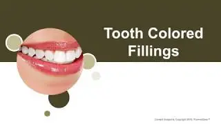 Tooth-Colored Fillings in Sherman, TX - Collins Family Dentistry