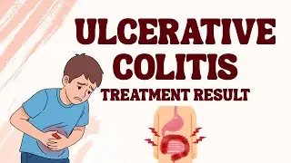 Ulcerative Colitis Improvement Story | Homeopathy | Real Online Case