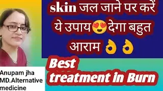 Heal Skin Burns FAST with Theses Acupressure Points !/जल जाने पर क्या करें।