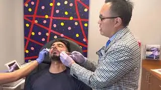 Dallas Botox for Acne Scarring & Acne?  Yes!!!