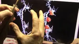 RFK jr Digestive Bacteria Replacement (FMT) Looks Very Promising for Chronic Issues....Please Look