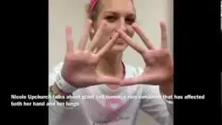 Nicole Upchurch discusses the rare condition affecting her hands