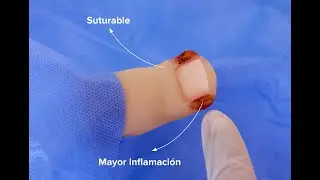 Simulador de Ortejo - Toe Simulator - Plan 3D
