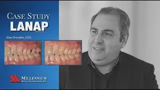 Case study: Saving a tooth with 12mm pocket depths using LANAP protocol