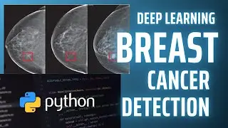 Breast Cancer Classification with Neural Network | Deep Learning Projects in Python