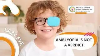 HOW WE TREAT A LAZY EYE. AMBLYOPIA