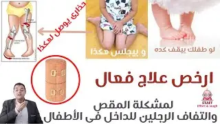حل انحراف قدم الطفل للداخل عند المشي وعند الجري | intoeing | علاج التفاف القدم للداخل فى الأطفال