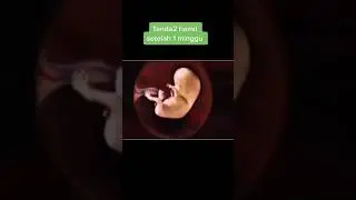Tanda-tanda Hamil Setelah 1 Minggu