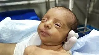 Baby burping procedure in Nicu adorable baby feeding 