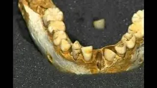 El Sidron Hotspot der  Neanderthaler Population