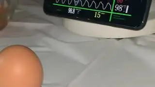 They performed surgery on the world famous egg