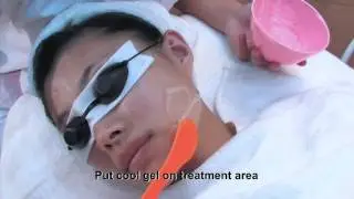 MED-150C IPL Hair Removal  depilaci&oacute;n