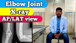 Elbow joint X-ray || AP / LAT view || RADIOGRAPHY