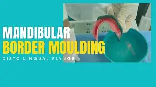 MANDIBULAR BORDER MOULDING - DISTOLINGUAL AREA