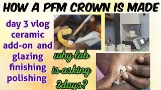 how a PFM crown is made || ceramic add-on glazing finishing day 3