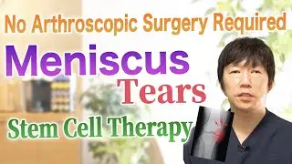Regenerative Medicine for Meniscus Tears 【Doctor's Detailed Explanation with Actual Cases】