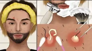 ASMR❗ Ingrown hairs, acne, extrusion animation, shaving,and job interview preparation care animation