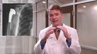 Shoulder Arthritis and Treatment Options