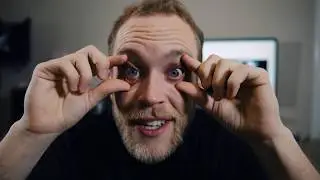 What is Lasik Eye Surgery Like? I Got Lasik Eye Surgery, My Eyes Were Burned?!