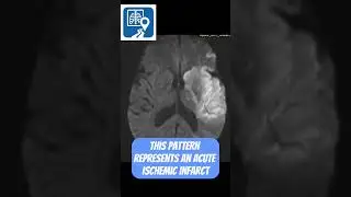 Something&rsquo;s Not Right Here&hellip; MRI Clue Explained #shorts