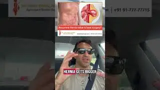 Hernia mesh explained: why surgeons use it and how it keeps repairs strong
