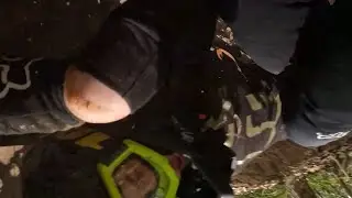 Downhill run turns into a big mistake (3 months off bike and snapped wrist)