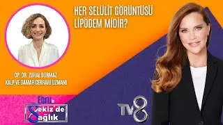HER SELÜLİT GÖRÜNTÜSÜ LİPÖDEM MİDİR?| OP. DR. ZUHAL DURMAZ | 8'de Sağlık