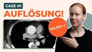 Messungen in der CTA Aorta: Was Radiologen wissen sollten! Auflösung 