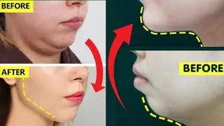 Anti-Aging Face Massage for High CHEEKBONES  _ Lift Up Saggy Cheeks, Jowls _ Get Slim Face Naturally