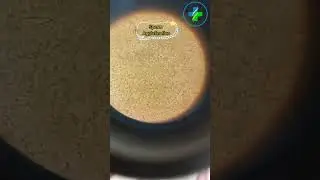 Semen analysis | sperm Agglutination | sperm under microscope | Sperm count | male fertility test