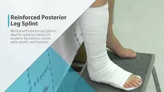 [APPLICATION] 04 Reinforced Posterior Leg Splint (Eng.)