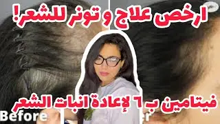 حقن فيتامين ب٦ لمقاومة الصلع و اعادة انبات الشعر و ازاي نعمل منها ارخص تونر للشعر |فرح محسن Drjoy
