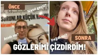 LAZER GÖZ AMELİYATI OLDUM | Göz Çizdirme Ameliyatı | Öncesi Sonrası ve Tüm Süreç