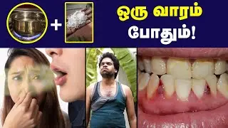 Teeth Care : இத செஞ்சா சொத்தைப்பல்லே வராது| how to avoid mouth bad smell : Doctor Advise