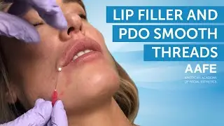 Adding Lip Definition with PDO Smooth Threads | AAFE