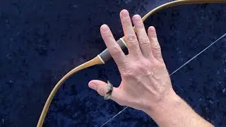 5 Reasons Your Thumb Ring Hurts