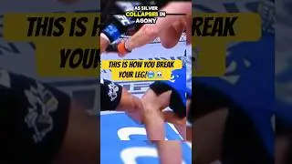 Anderson Silva&rsquo;s Bone-Chilling Leg Break😱💔 | UFC&rsquo;s Most Shocking Injury! #sports #shorts #mma #ufc