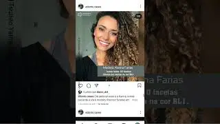 Facetas de resina