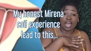 My honest Mirena IUD/coil review: 4 months post insertion