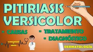PITIRIASIS VERSICOLOR TRATAMIENTO Y CAUSAS | Diagnóstico - Diagnóstico diferencial 📝👨🏻‍⚕️