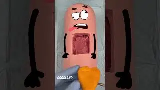 What REALLY Happens During Sausage Surgery in Goodland