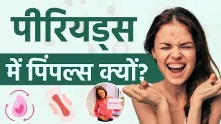 Period Pimples: पीरियड्स के दौरान क्यों होते हैं पिंपल्स? देखें ये पूरी वीडियो