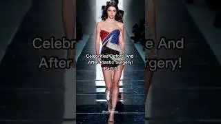 Celebrities before and after plastic surgery (Part 4). #shorts