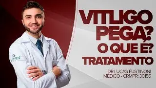 VITILIGO Pega? O que &eacute;? Qual &eacute; o Tratamento? - Dr Lucas Fustinoni - CRMPR 30155