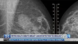 Metro Health debuts breast cancer detection technology