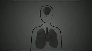 AIR POLLUTION Is the main Issue : Public Awareness.