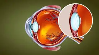 Human Eye - Class 10 Tutorial